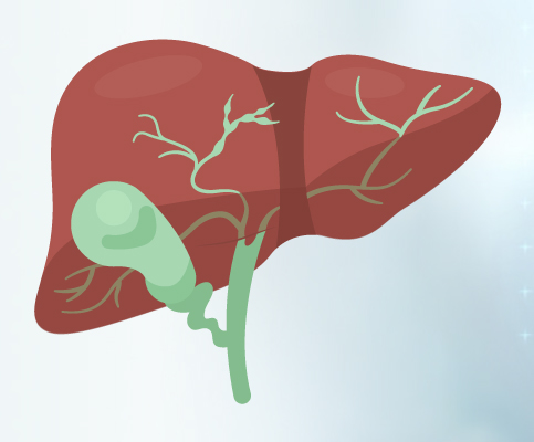 Primary Biliary Cholangitis – Dr Ravindra Nidoni